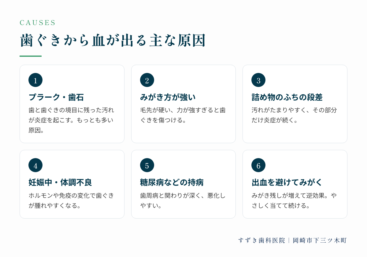 歯ぐきから血が出る主な原因6つ:プラーク・歯石、みがき方が強い、詰め物のふちの段差、妊娠中・体調不良、糖尿病などの持病、出血を避けてみがく